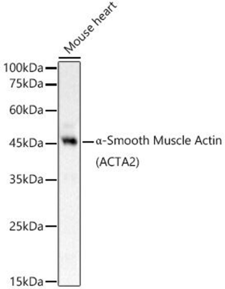 Anti-alpha smooth muscle Actin Antibody, 100 µl