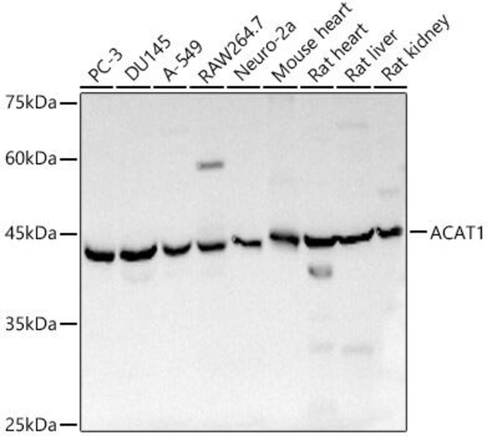 Anti-ACAT1 Antibody, 100 µl