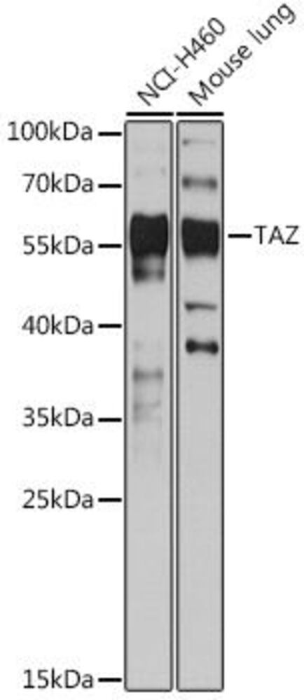 Anti-TAZ Antibody