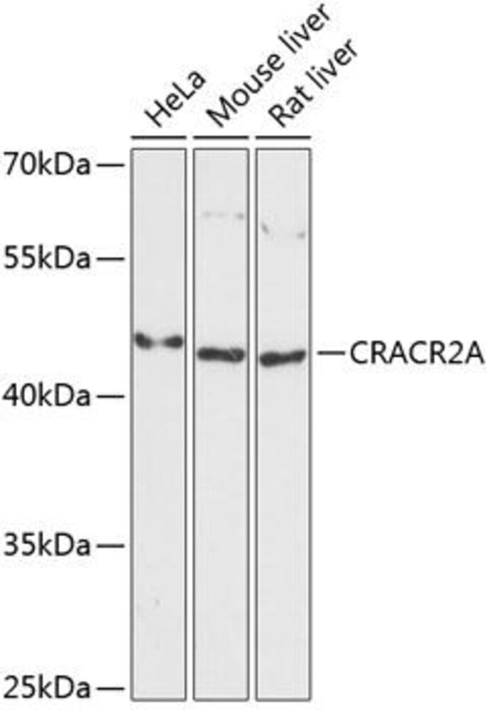 Anti-CRACR2A Antibody