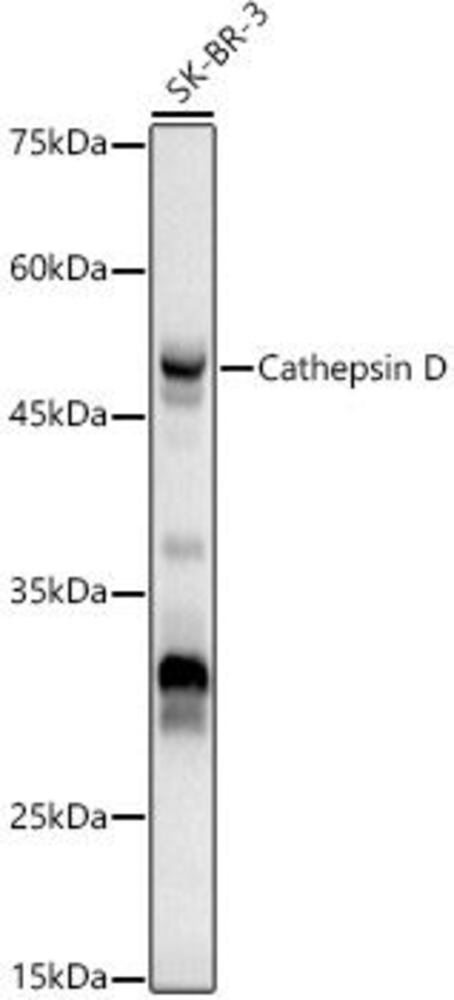 Anti-Cathepsin D Antibody, 100 µl