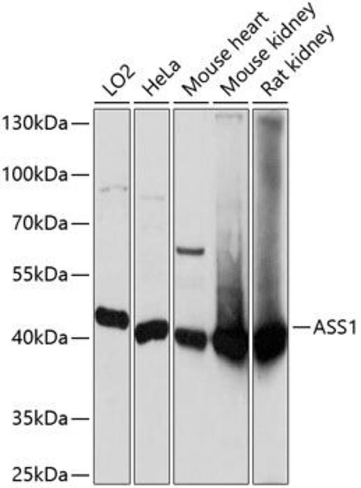 Anti-ASS1 Antibody, 100 µl