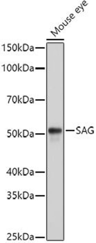 Anti-Retinal S antigen Antibody, 100 µl