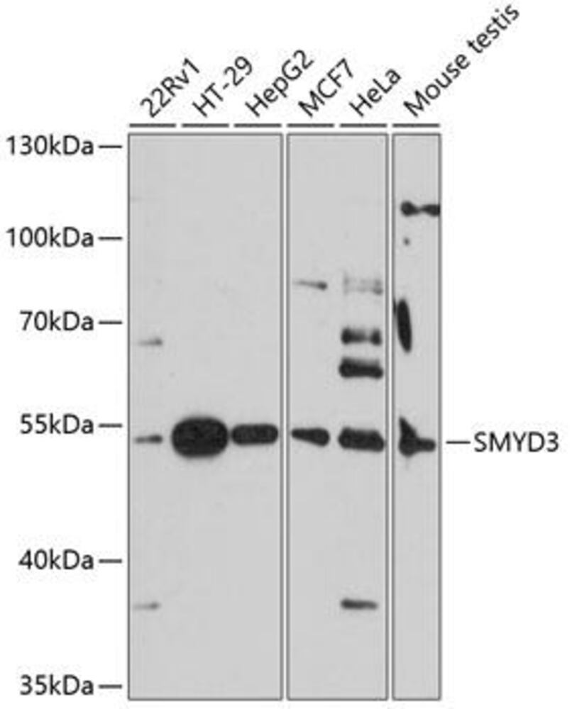 Anti-SMYD3 Antibody, 100 µl