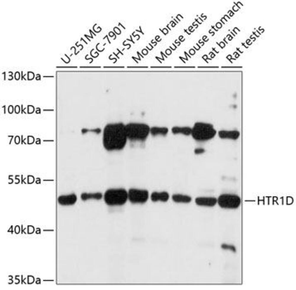 Anti-5HT1D Receptor Antibody
