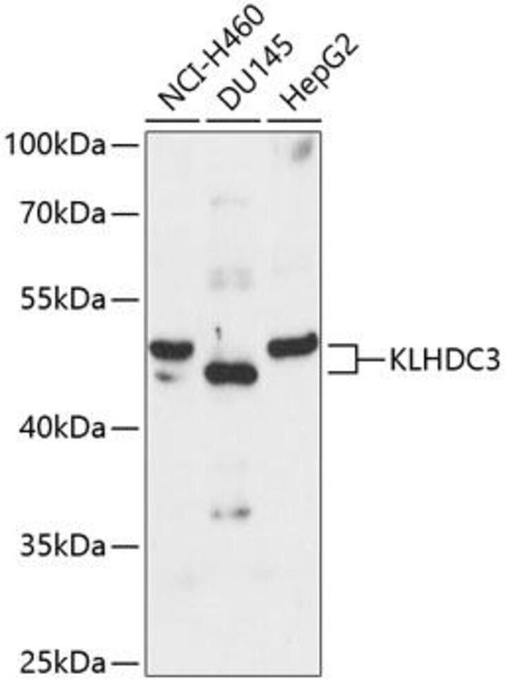 Anti-KLHDC3 Antibody, 100 µl