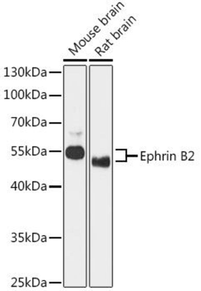 Anti-Ephrin B2 Antibody, 100 µl