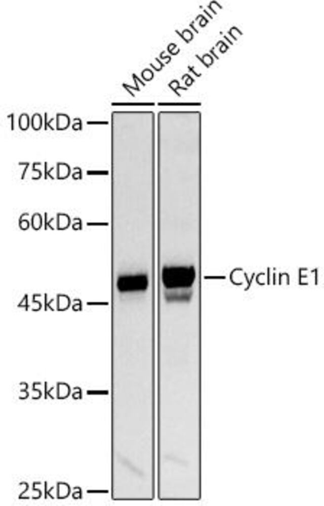 Anti-Cyclin E1 Antibody, 100 µl