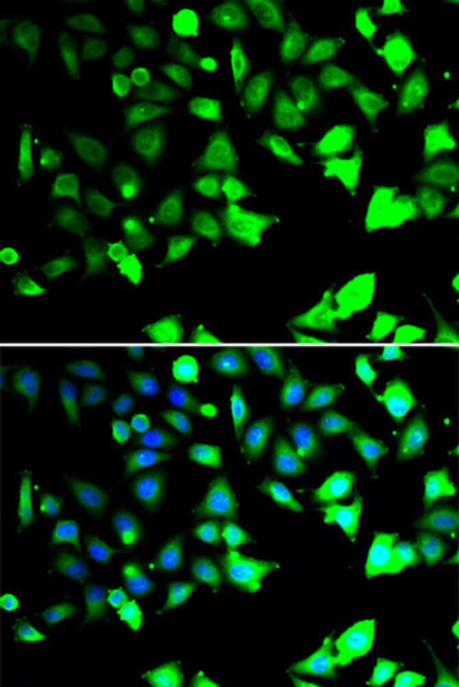 Anti-XIAP Antibody