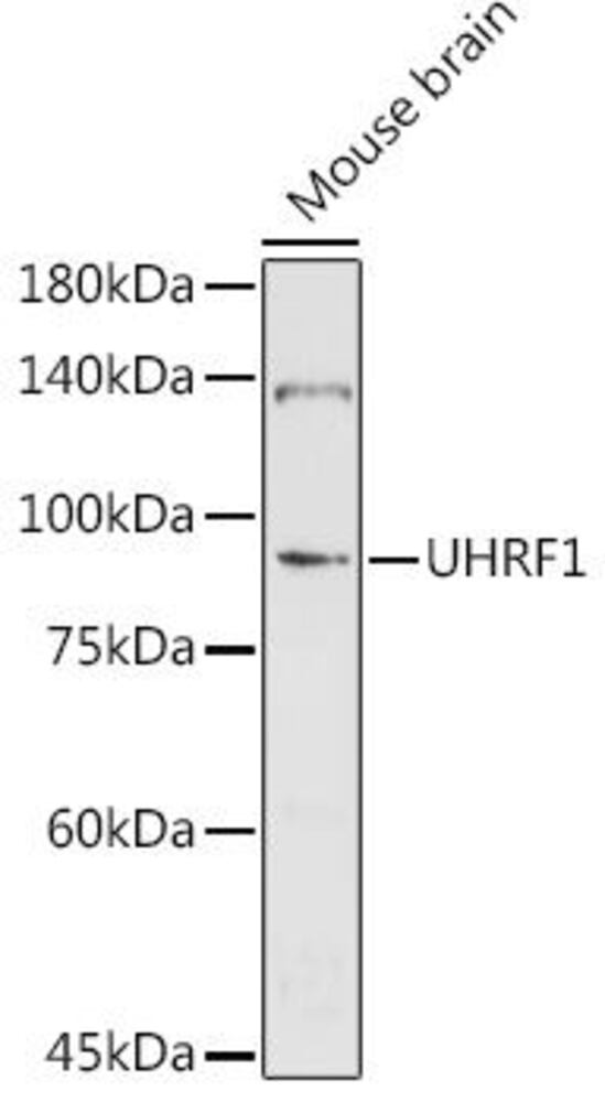 Anti-UHRF1 Antibody, 100 µl