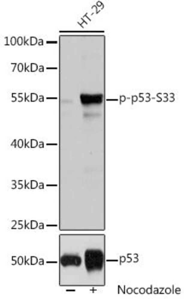 Anti-p53 (phospho Ser33) Antibody, 100 µl