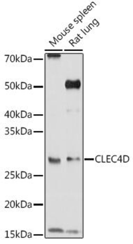 Anti-CLEC4D Antibody, 100 µl