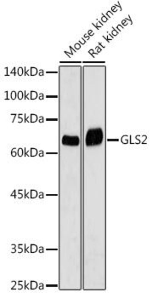 Anti-GLS2 Antibody, 100 µl