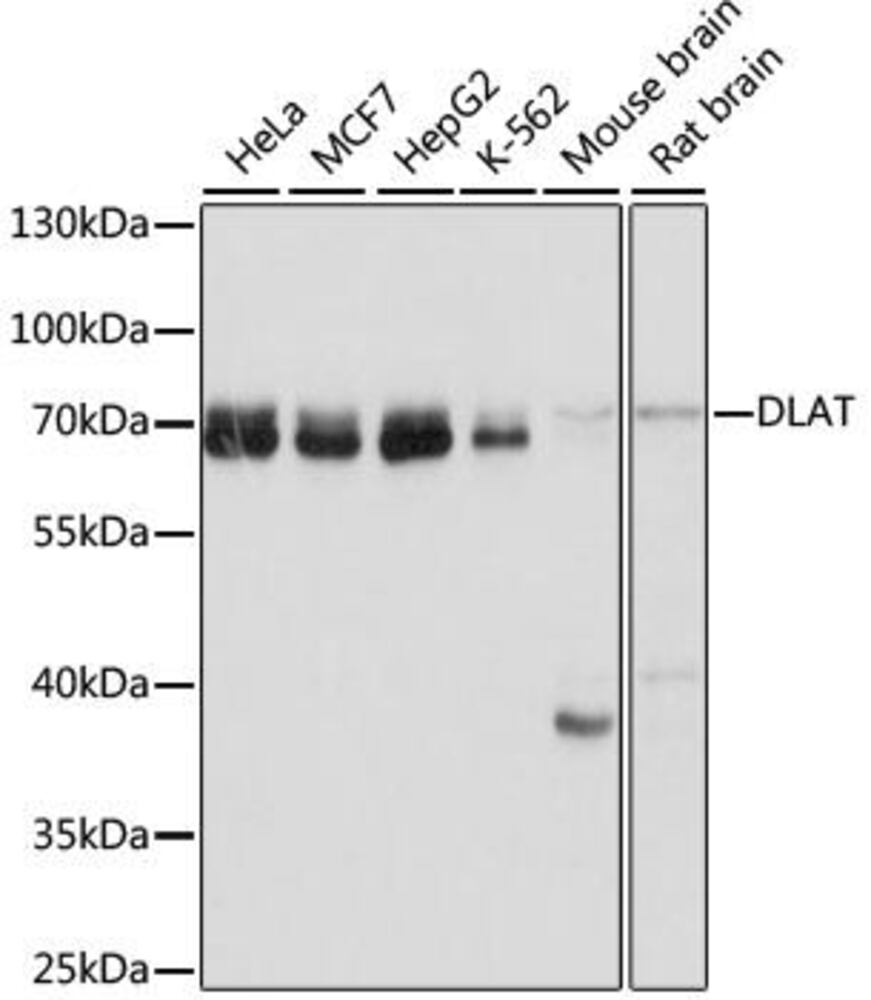 Anti-Pyruvate Dehydrogenase E2 Antibody