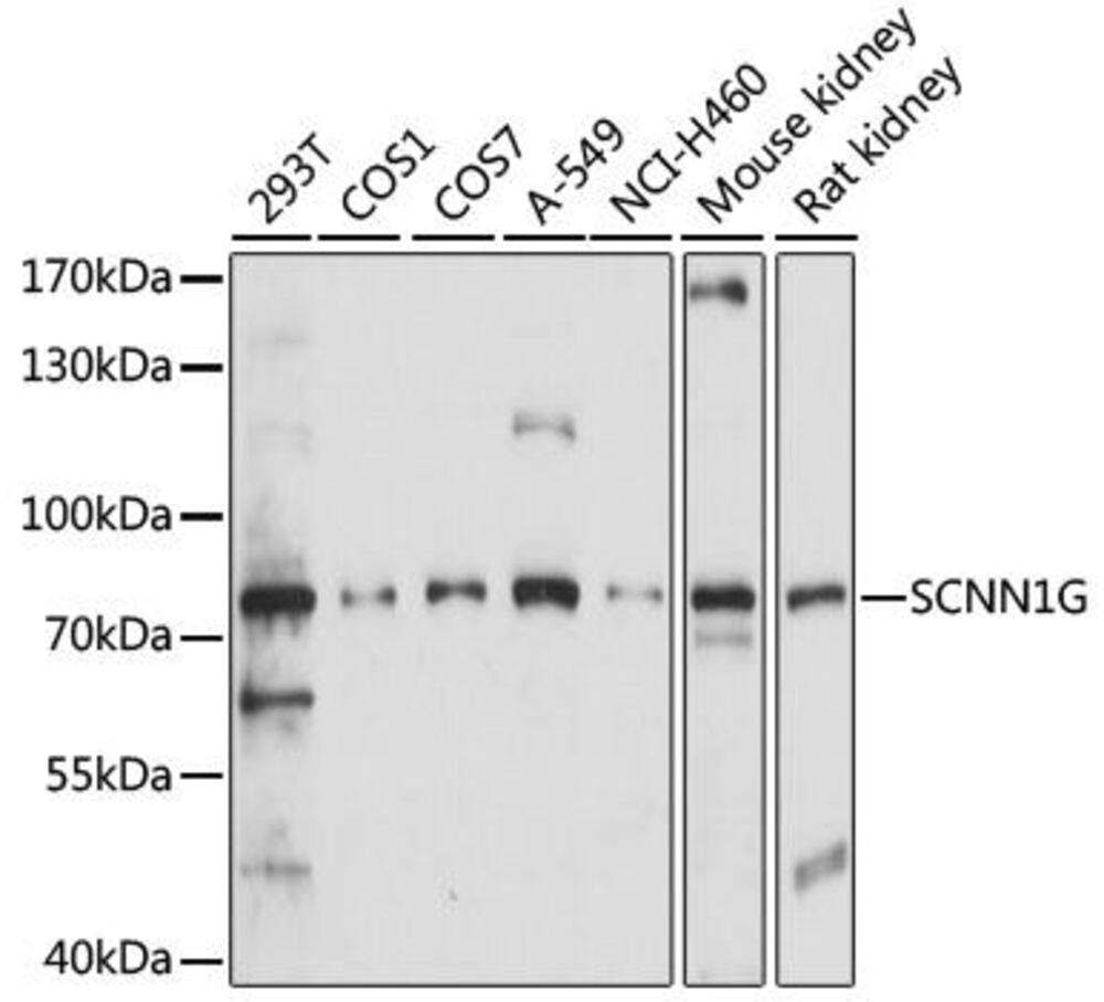 Anti-SCNN1G Antibody, 100 µl