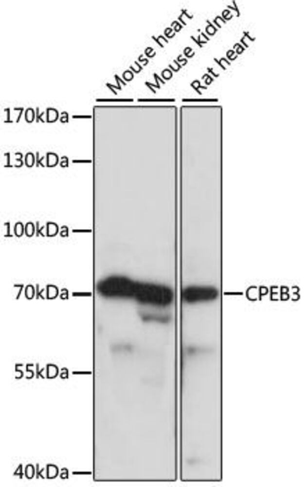 Anti-CPEB3 Antibody, 100 µl