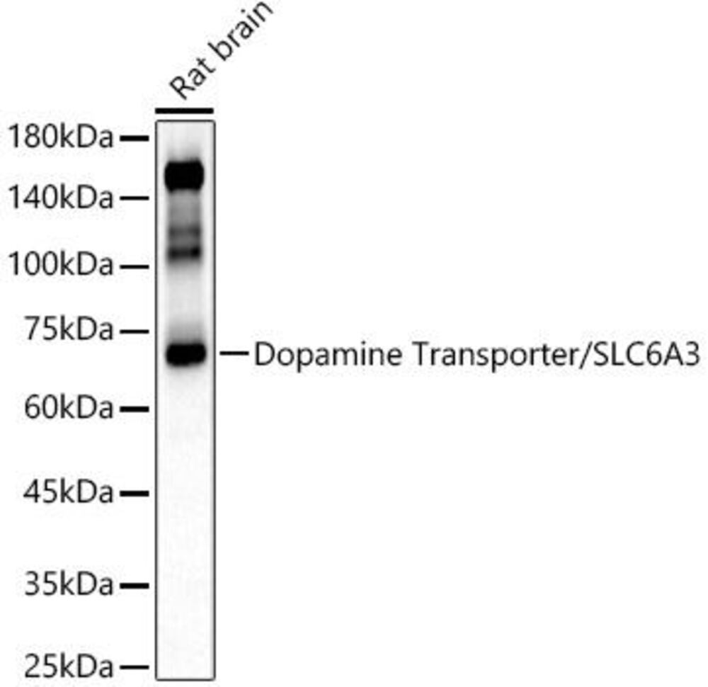 Anti-Dopamine Transporter Antibody, 100 µl