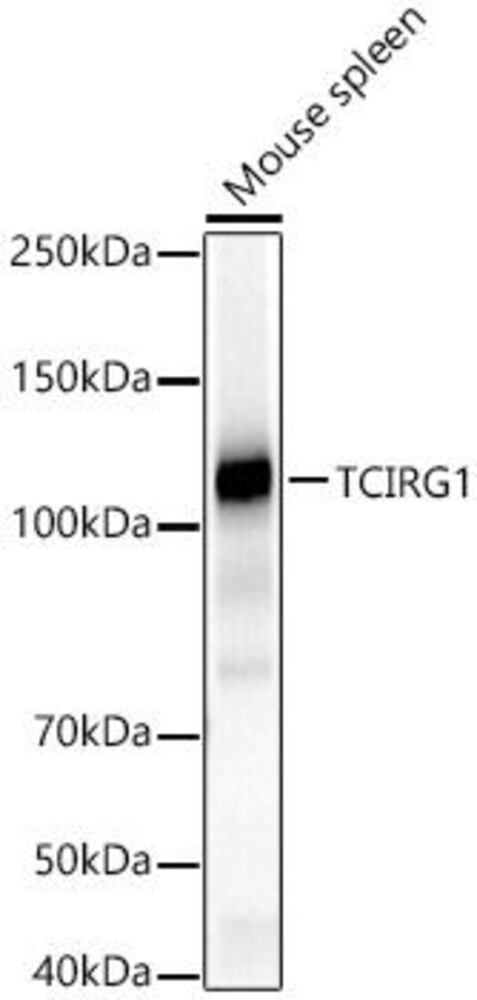 Anti-TCIRG1 Antibody, 100 µl