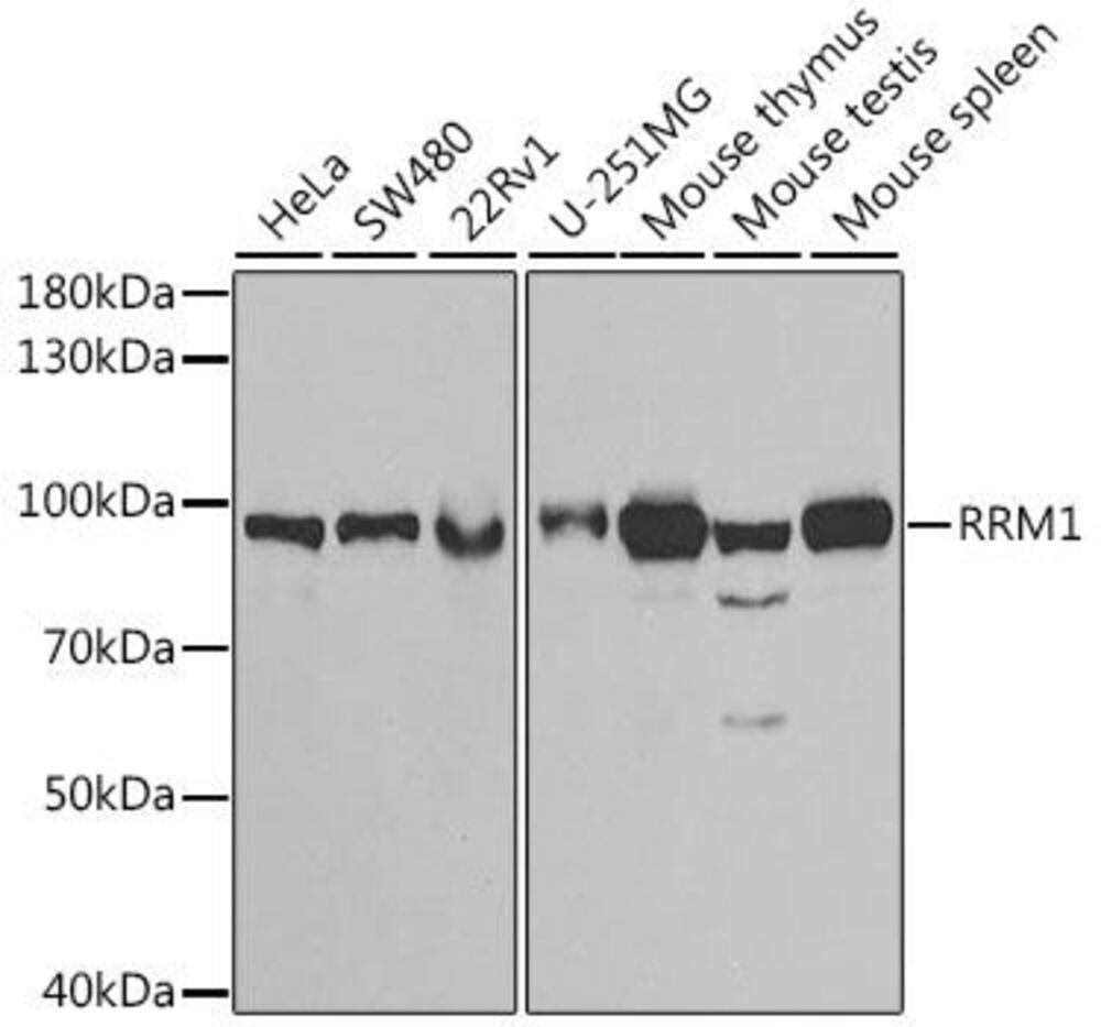 Anti-RRM1 Antibody