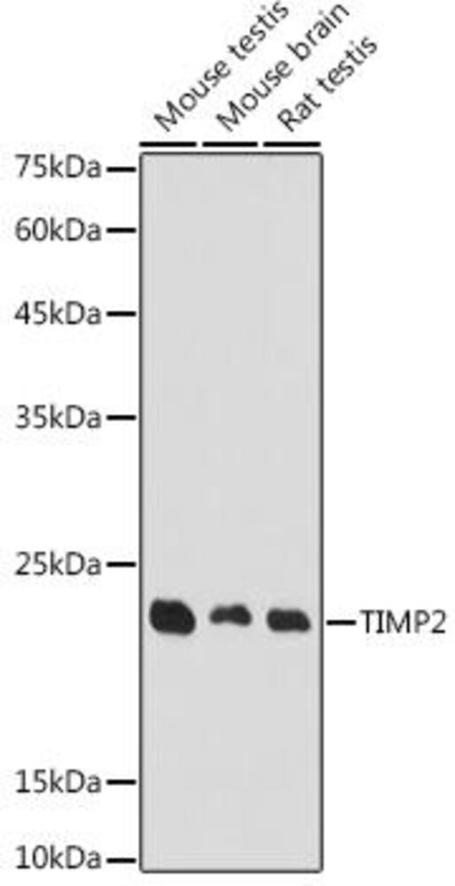Anti-TIMP2 Antibody