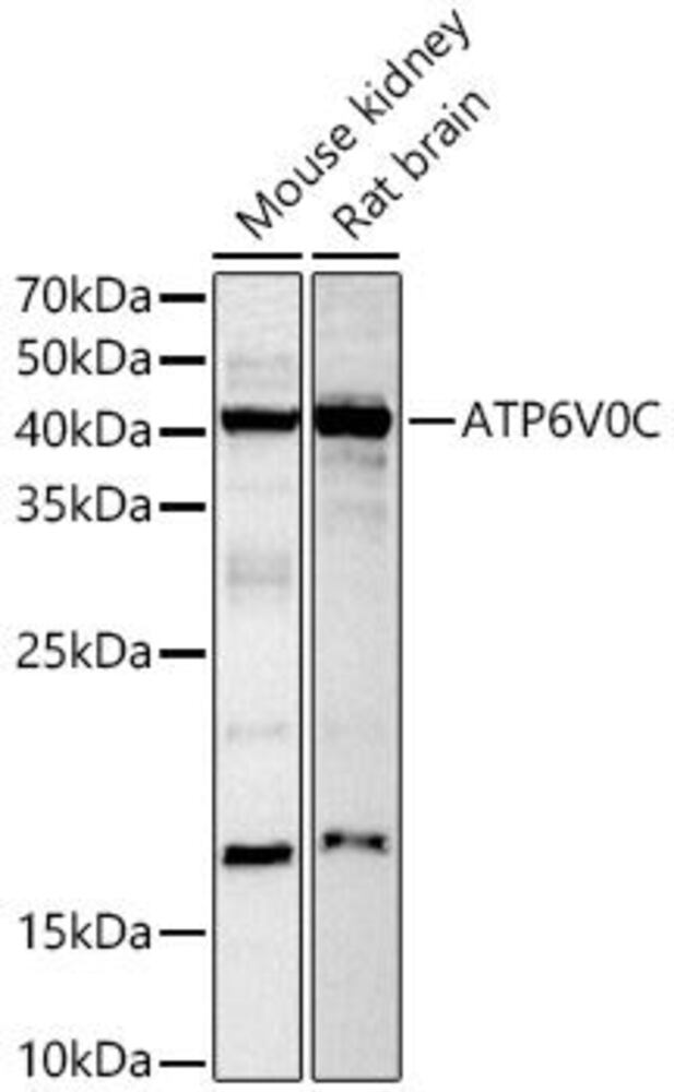 Anti-ATP6V0C Antibody, 100 µl