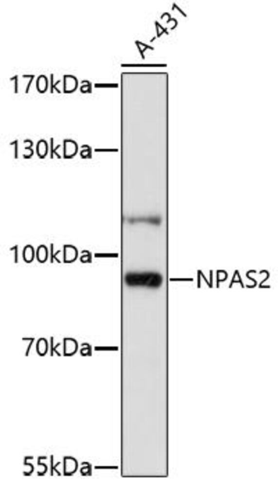 Anti-NPAS2 Antibody, 100 µl