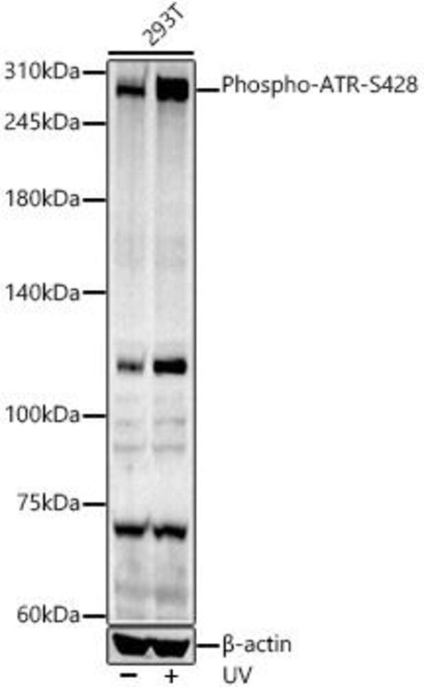 Anti-ATR (phospho Ser428) Antibody