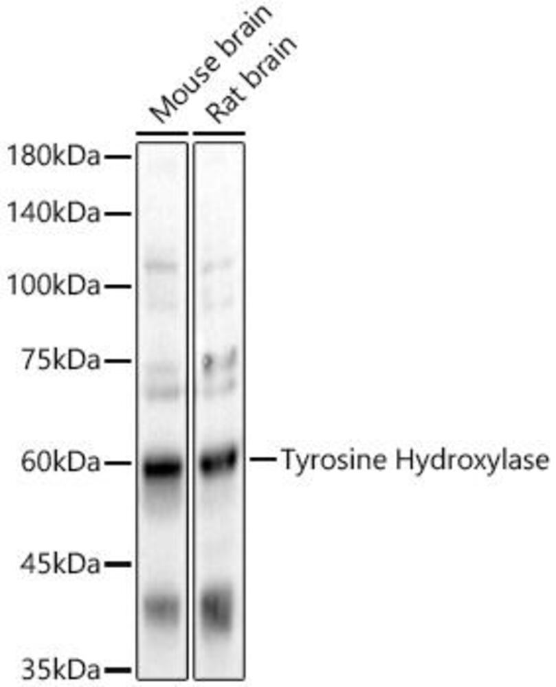 Anti-Tyrosine Hydroxylase Antibody, 100 µl