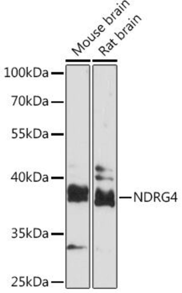Anti-NDRG4 Antibody