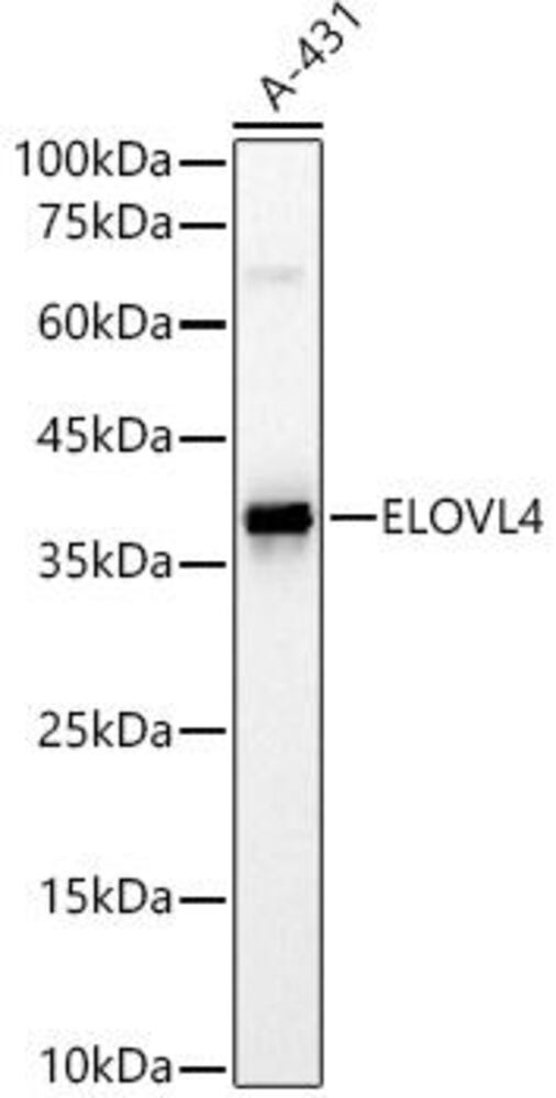 Anti-ELOVL4 Antibody, 100 µl
