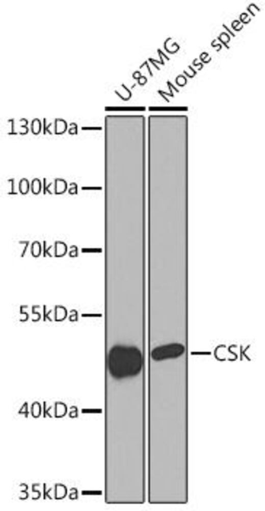 Anti-CSK Antibody, 100 µl