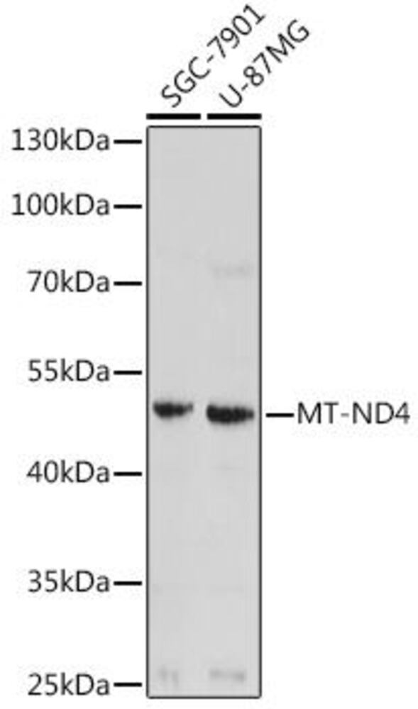Anti-ND4 Antibody, 100 µl