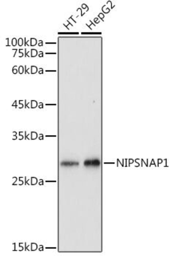 Anti-NIPSNAP1 Antibody, 100 µl