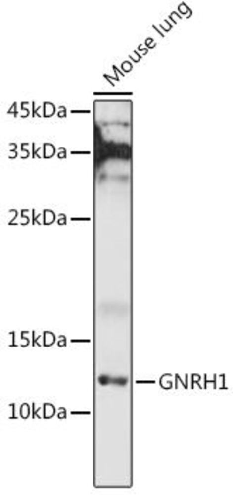 Anti-GnRH Antibody, 100 µl
