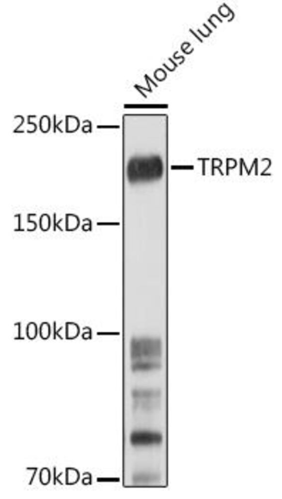 Anti-TRPM2 Antibody, 100 µl