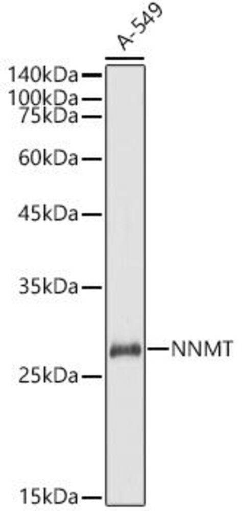 Anti-NNMT Antibody, 100 µl