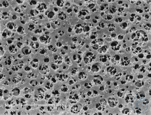 CA white, sterile, 0.45 µm, Cellulose Acetate (CA) Membrane Filter - Luminix Health