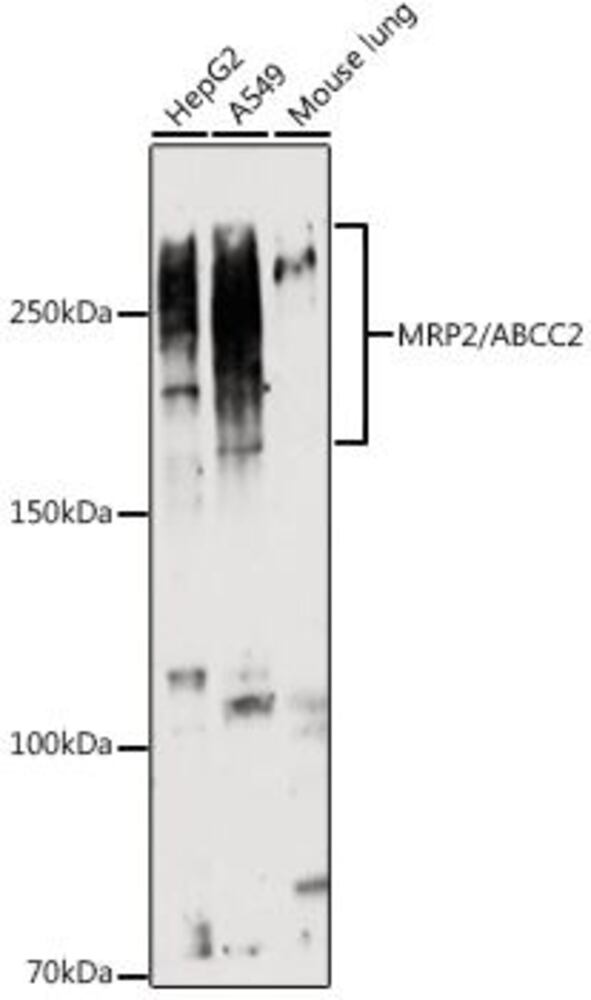 Anti-MRP2 Antibody, 100 µl - Luminix Health