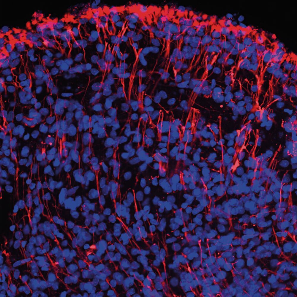 Anti-Nestin Antibody, 50 µl - Luminix Health