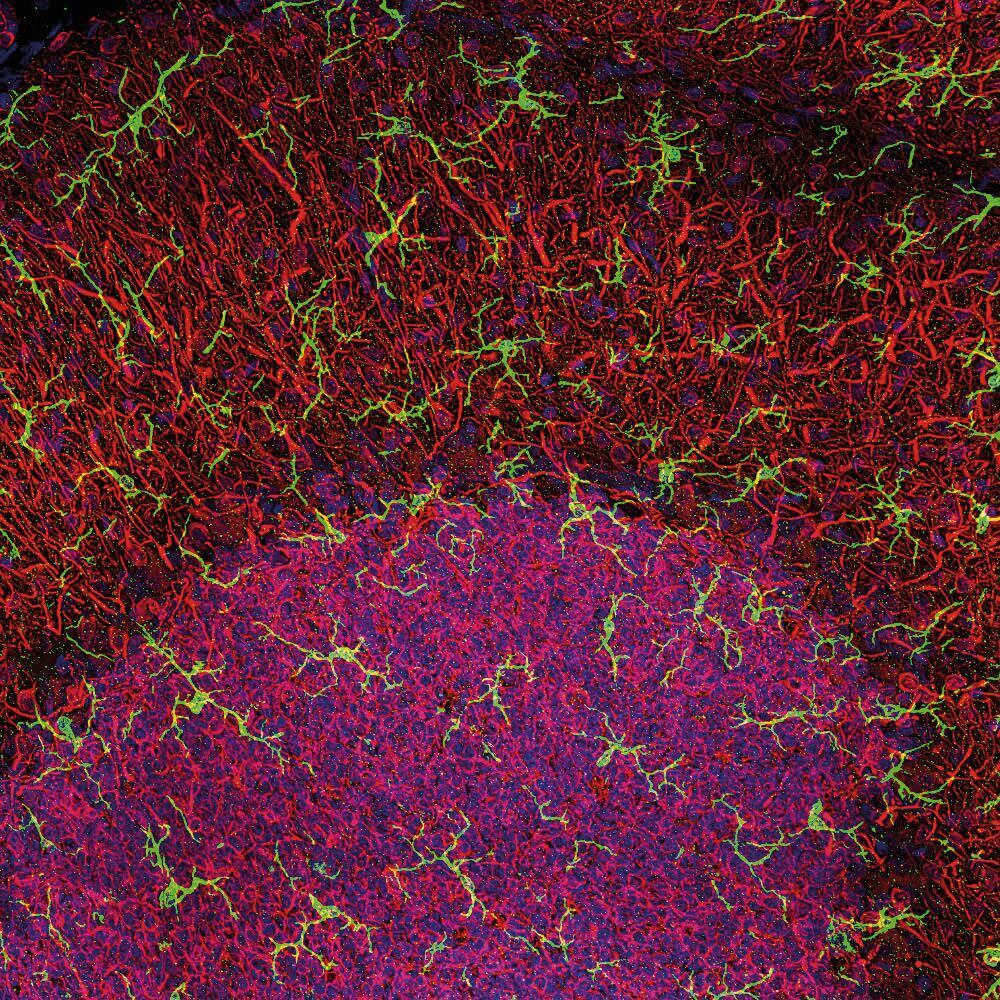 Anti-Iba1 Antibody, 50 µl - Luminix Health
