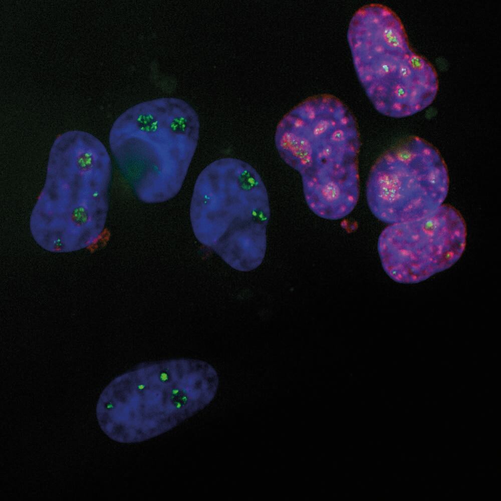 Anti-Ki67 Antibody, 50 µl - Luminix Health