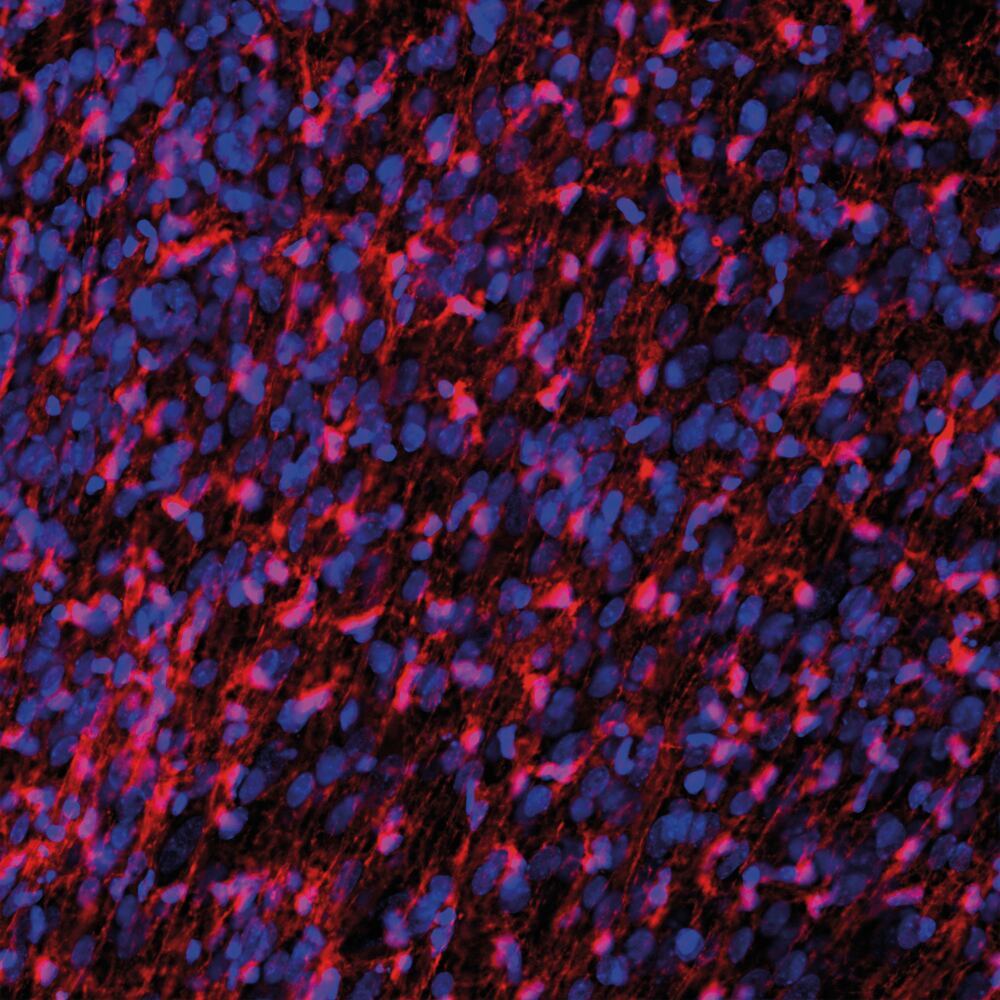 Anti-FABP7 Antibody, 50 µl - Luminix Health