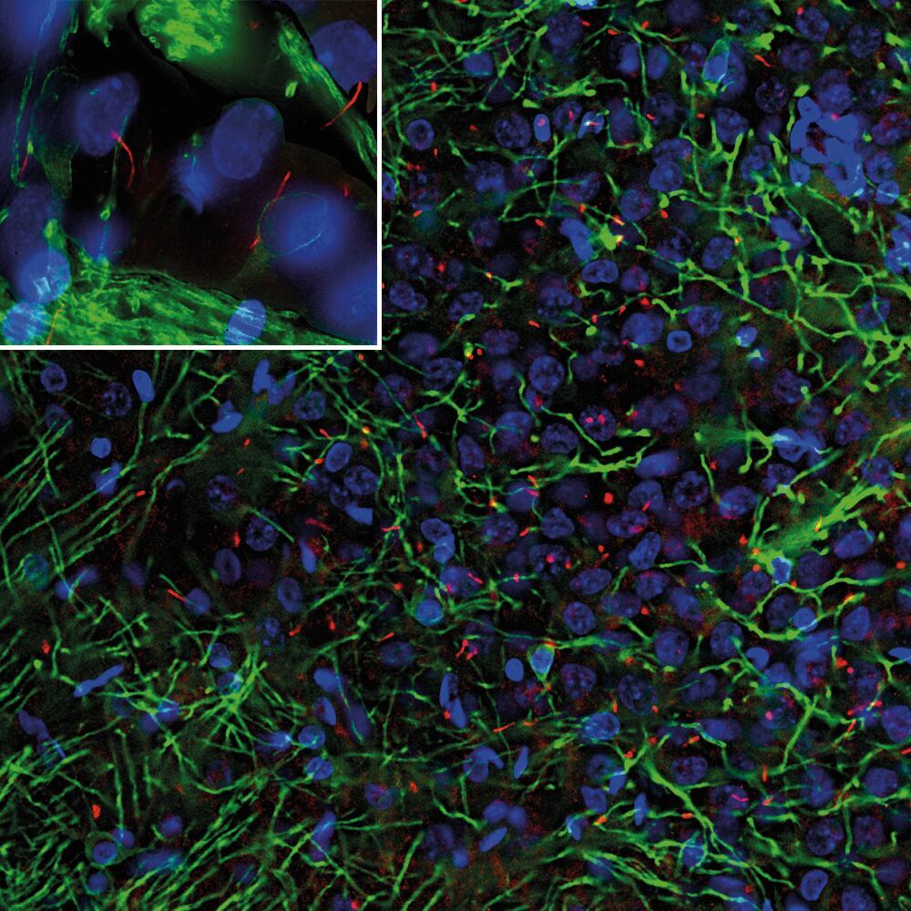 Anti-Adenylate Cyclase 3 Antibody, 50 µl - Luminix Health