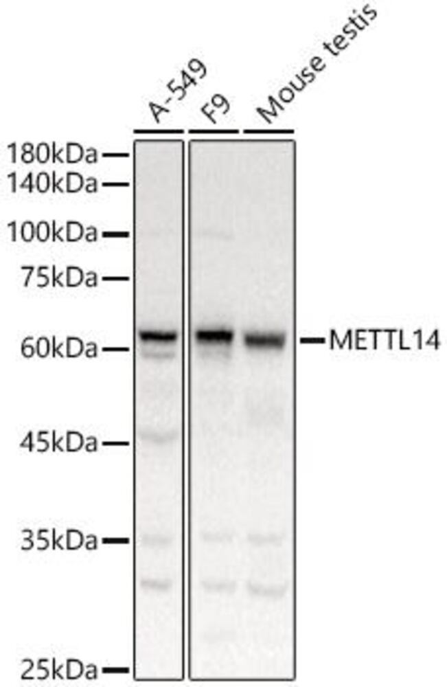 Anti-METTL14 Antibody, 100 µl - Luminix Health