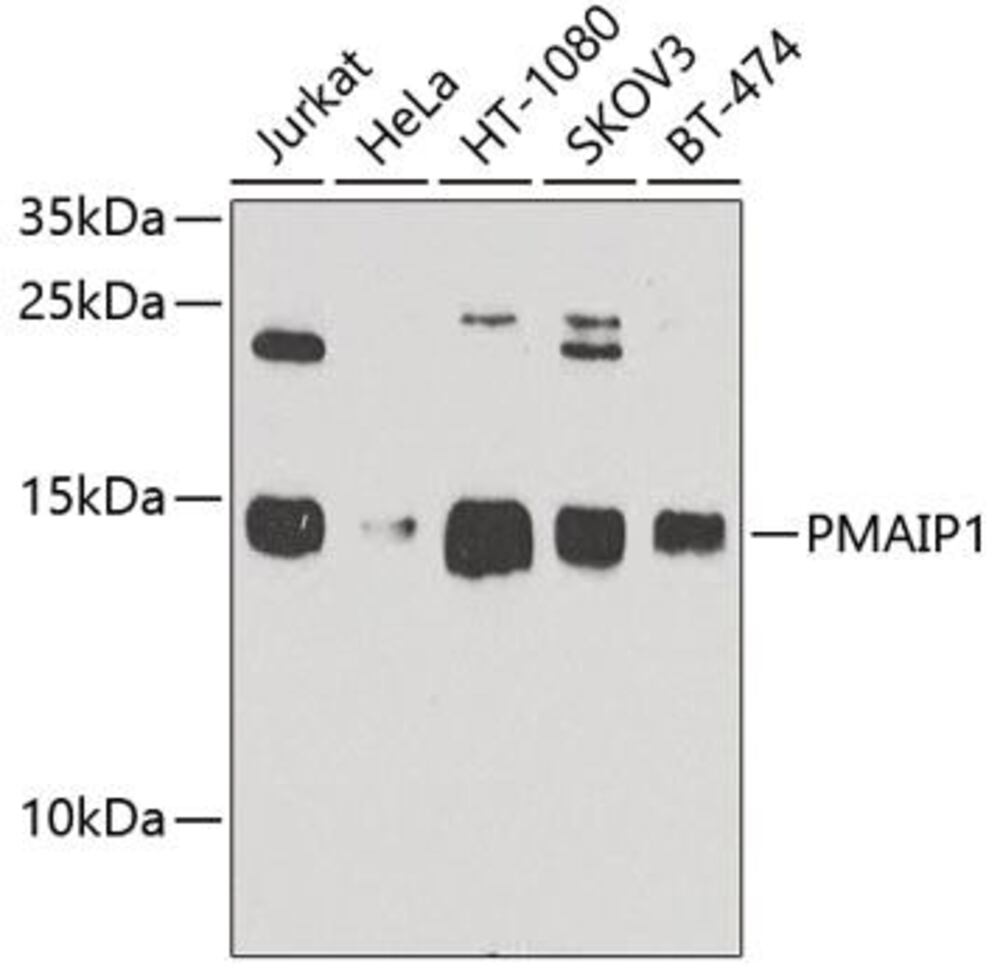 Anti-Noxa Antibody, 100 µl - Luminix Health