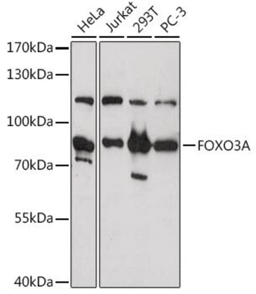 Anti-FOXO3A Antibody, 100 µl - Luminix Health