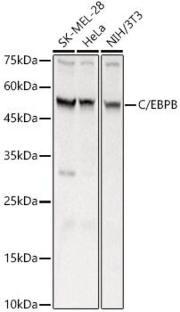 Anti-CEBP Beta Antibody, 100 µl - Luminix Health