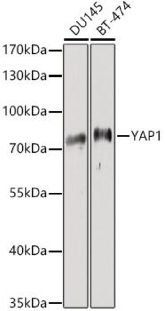 Anti-YAP1 Antibody, Density (D) 1 g/cm³, Storage temp. +4 °C - Luminix Health