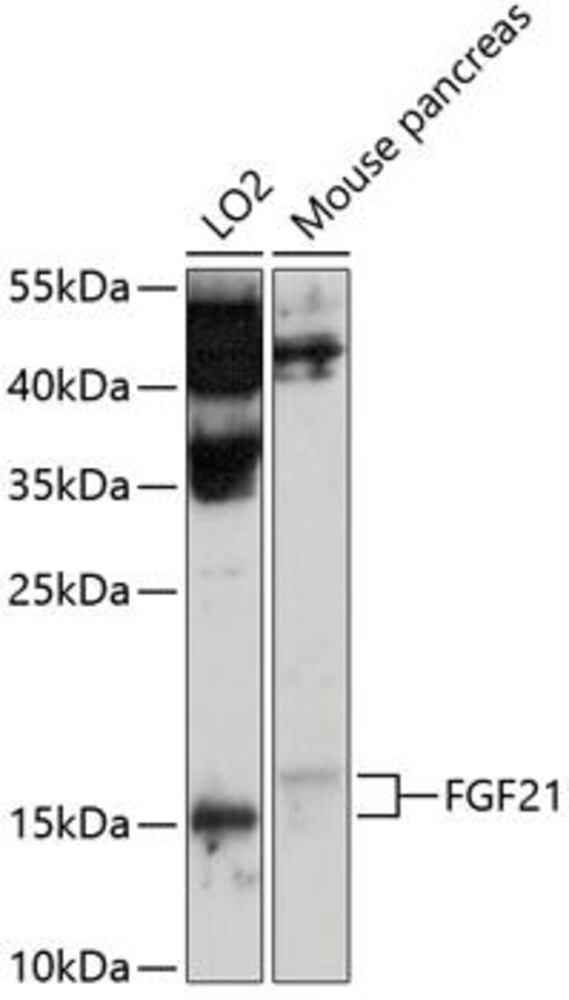 Anti-FGF21 Antibody, 100 µl - Luminix Health