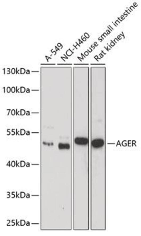Anti-RAGE Antibody, 100 µl - Luminix Health